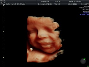 34 WKS 4d baby scan oxfordshire 